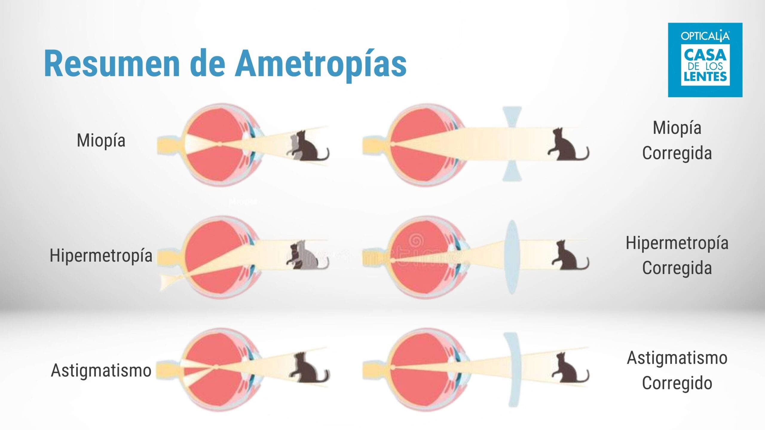 Ametropias